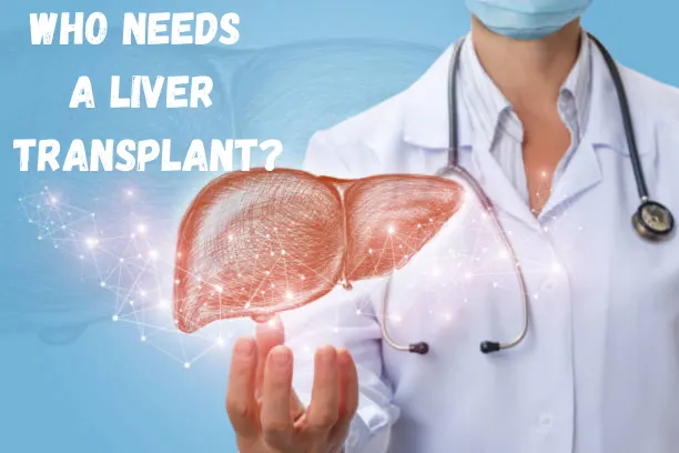 An close-up photograph features a doctor wearing a white lab coat, stethoscope, and medical mask, with their right hand cupped and outstretched in the foreground. Above the doctor's hand, a digital, copper-colored wireframe rendering of a human liver floats, connected by a faint web of white lines and dots. In the background is a translucent blue-and-white graphic of a brain and anatomical sketches. At the top of the image, the text reads: "Who needs a liver transplant?