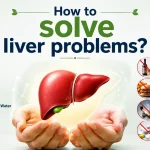 Doctor-style infographic explaining how to solve liver problems naturally with healthy diet, exercise, hydration, stress management, and avoiding alcohol, smoking, junk food, and unnecessary medications.