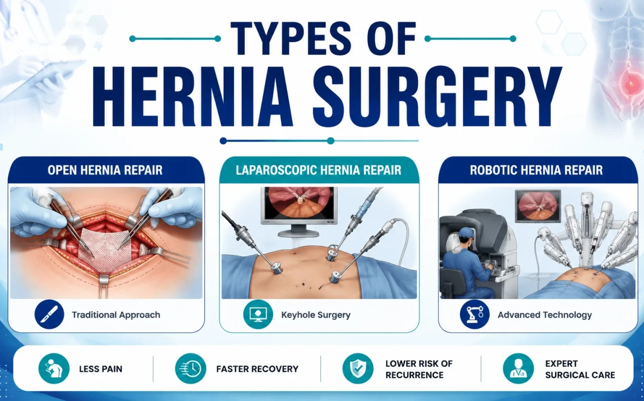 Types of hernia surgery illustration showing open, laparoscopic, and robotic hernia repair procedures with abdominal wall treatment and surgical mesh reinforcement.