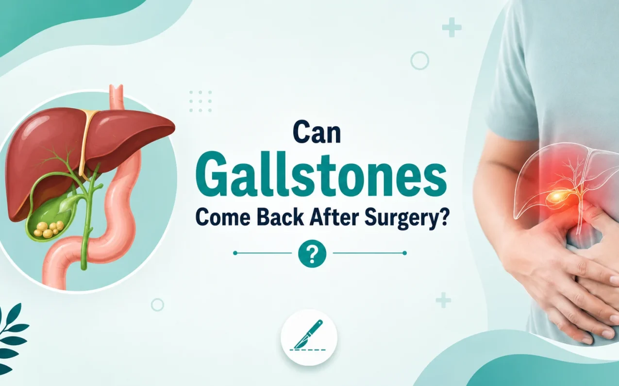 Can gallstones come back after surgery explained with gallbladder and bile duct illustration showing post gallbladder removal risk and prevention