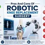 Orthopedic surgeon performing robotic knee replacement surgery with robotic-assisted technology, highlighting implant positioning, surgical precision, benefits, risks, and recovery outcomes.