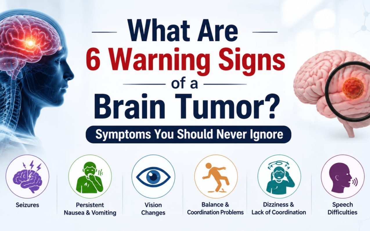 Illustration showing six warning signs of a brain tumor, including seizures, persistent nausea and vomiting, vision changes, balance problems, dizziness, and speech difficulties.