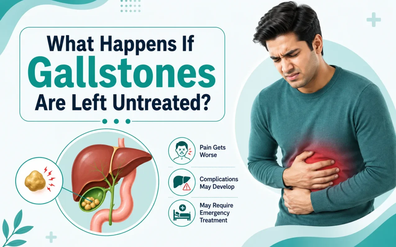 Medical illustration showing gallstones in the gallbladder and complications such as inflammation jaundice pancreatitis and gallbladder infection caused by untreated gallstones.
