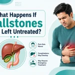 Medical illustration showing gallstones in the gallbladder and complications such as inflammation jaundice pancreatitis and gallbladder infection caused by untreated gallstones.