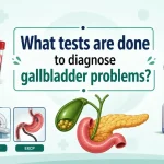Infographic showing blood tests and imaging scans used to diagnose gallbladder problems including liver tests ultrasound CT scan HIDA MRCP and ERCP