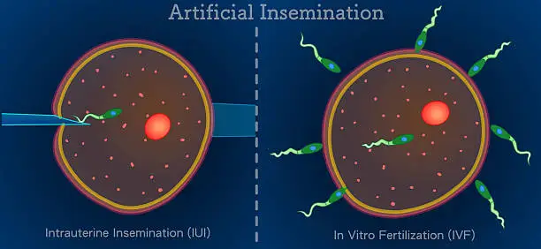 Illustration comparing IUI (intrauterine insemination) and IVF (in vitro fertilization) procedures