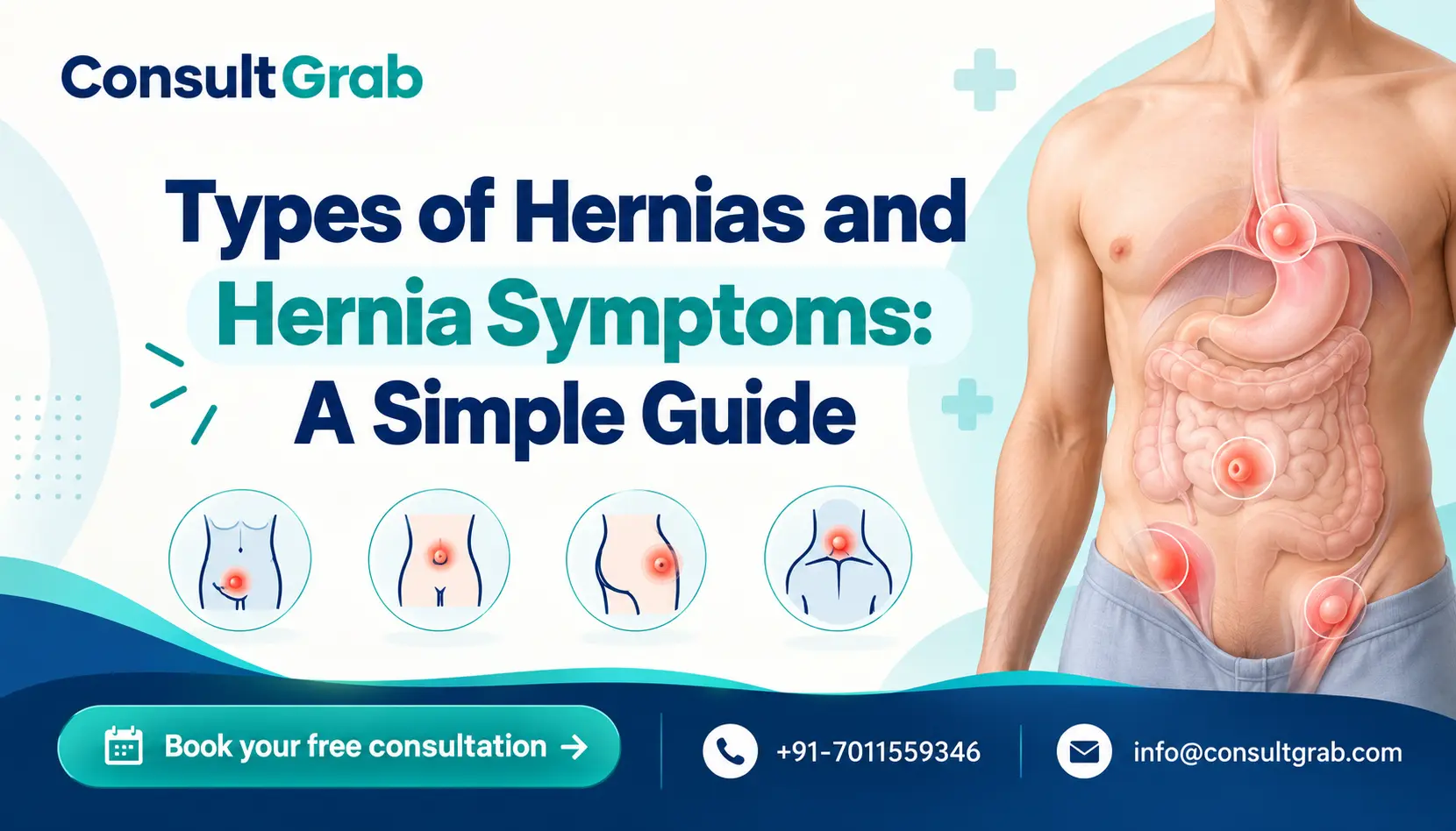 Types of Hernias and Hernia Symptoms: A Simple Guide