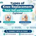 Types of Knee Replacement: Total, Half and Kneecap Explained - diagram of the three knee parts